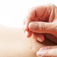 Besøg Boel Akupunktur for hurtig bedring